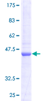 ab164643 on a 12.5% SDS-PAGE stained with Coomassie Blue.