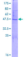 ab164644 on a 12.5% SDS-PAGE stained with Coomassie Blue.