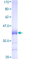 ab164645 on a 12.5% SDS-PAGE stained with Coomassie Blue.