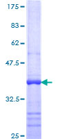 ab159679 on a 12.5% SDS-PAGE stained with Coomassie Blue.