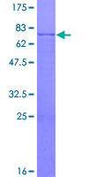ab158188 on a 12.5% SDS-PAGE stained with Coomassie Blue.