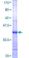 ab158189 on a 12.5% SDS-PAGE stained with Coomassie Blue.
