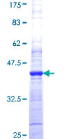 ab162456 on a 12.5% SDS-PAGE stained with Coomassie Blue.