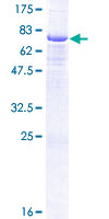 ab164953 on a 12.5% SDS-PAGE stained with Coomassie Blue.