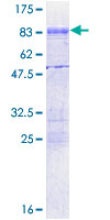 ab163845 on a 12.5% SDS-PAGE stained with Coomassie Blue.