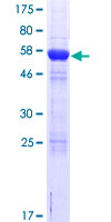ab164250 on a 12.5% SDS-PAGE stained with Coomassie Blue.