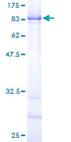 ab160249 on a 12.5% SDS-PAGE stained with Coomassie Blue.