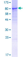 ab165339 on a 12.5% SDS-PAGE stained with Coomassie Blue.