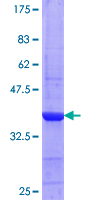 ab165341 on a 12.5% SDS-PAGE stained with Coomassie Blue.