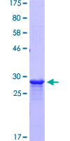 ab163628 on a 12.5% SDS-PAGE stained with Coomassie Blue.
