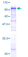 ab160452 on a 12.5% SDS-PAGE stained with Coomassie Blue.