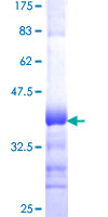 ab162091 on a 12.5% SDS-PAGE stained with Coomassie Blue.