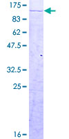 ab162711 on a 12.5% SDS-PAGE stained with Coomassie Blue.