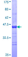 ab162712 on a 12.5% SDS-PAGE stained with Coomassie Blue.