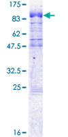 ab161268 on a 12.5% SDS-PAGE stained with Coomassie Blue.