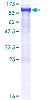 ab153359 on a 12.5% SDS-PAGE stained with Coomassie Blue.