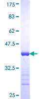 ab153360 on a 12.5% SDS-PAGE stained with Coomassie Blue.