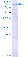 ab165244 on a 12.5% SDS-PAGE stained with Coomassie Blue.