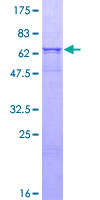 ab162760 on a 12.5% SDS-PAGE stained with Coomassie Blue.