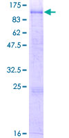 ab163373 on a 12.5% SDS-PAGE stained with Coomassie Blue.