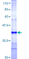 ab165156 on a 12.5% SDS-PAGE stained with Coomassie Blue.