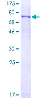 ab162449 on a 12.5% SDS-PAGE stained with Coomassie Blue.