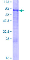 ab161017 on a 12.5% SDS-PAGE stained with Coomassie Blue.