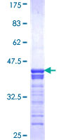 ab161018 on a 12.5% SDS-PAGE stained with Coomassie Blue.
