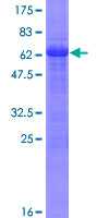 ab163871 on a 12.5% SDS-PAGE stained with Coomassie Blue.