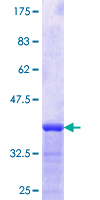ab163872 on a 12.5% SDS-PAGE stained with Coomassie Blue.