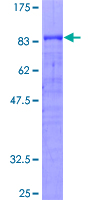 ab160560 on a 12.5% SDS-PAGE stained with Coomassie Blue.