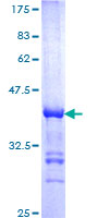 ab160561 on a 12.5% SDS-PAGE stained with Coomassie Blue.