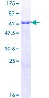 ab163997 on a 12.5% SDS-PAGE stained with Coomassie Blue.