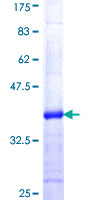 ab163998 on a 12.5% SDS-PAGE stained with Coomassie Blue.