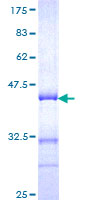 ab158197 on a 12.5% SDS-PAGE stained with Coomassie Blue.