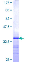 ab159744 on a 12.5% SDS-PAGE stained with Coomassie Blue.