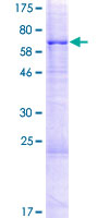 ab164429 on a 12.5% SDS-PAGE stained with Coomassie Blue.