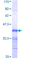 ab153361 on a 12.5% SDS-PAGE stained with Coomassie Blue.
