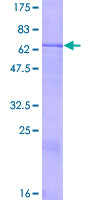 ab160397 on a 12.5% SDS-PAGE stained with Coomassie Blue.