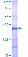 ab153480 on a 12.5% SDS-PAGE stained with Coomassie Blue.