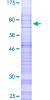 ab160875 on a 12.5% SDS-PAGE stained with Coomassie Blue.