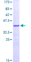 ab160876 on a 12.5% SDS-PAGE stained with Coomassie Blue.