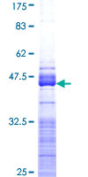 ab163416 on a 12.5% SDS-PAGE stained with Coomassie Blue.