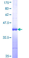 ab162656 on a 12.5% SDS-PAGE stained with Coomassie Blue.