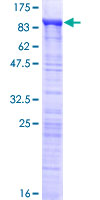 ab160489 on a 12.5% SDS-PAGE stained with Coomassie Blue.