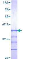 ab160490 on a 12.5% SDS-PAGE stained with Coomassie Blue.