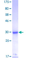 ab160491 on a 12.5% SDS-PAGE stained with Coomassie Blue.