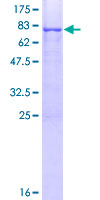 ab162966 on a 12.5% SDS-PAGE stained with Coomassie Blue.