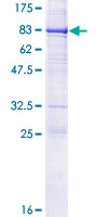 ab163368 on a 12.5% SDS-PAGE stained with Coomassie Blue.
