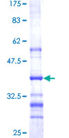 ab161020 on a 12.5% SDS-PAGE stained with Coomassie Blue.